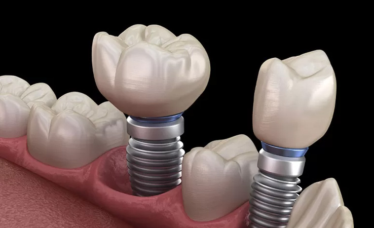 dental1